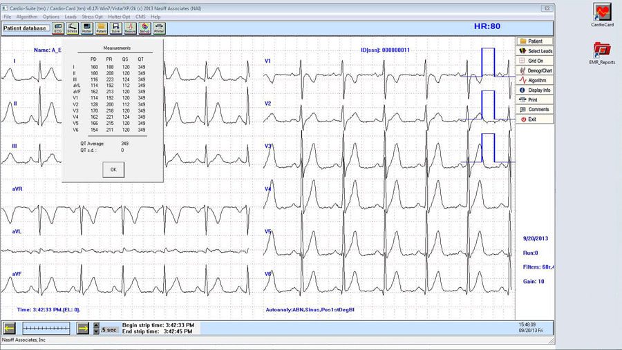 Cardioresting ECG Reports