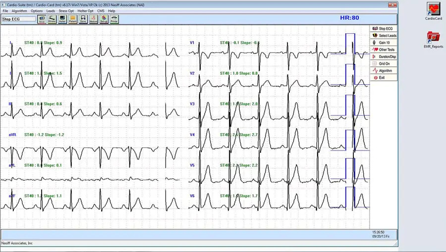 Resting ECG Reports in the System