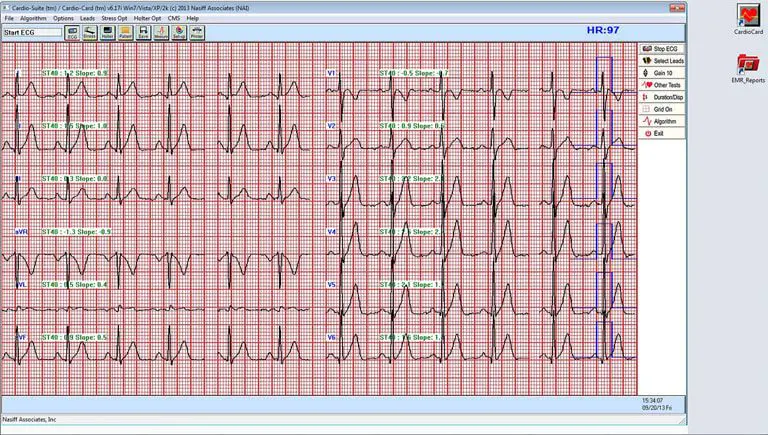 ​Cardio Universal EMR Interface