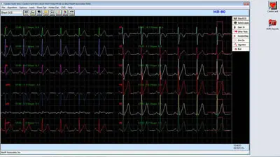 CardioResting ECG Data