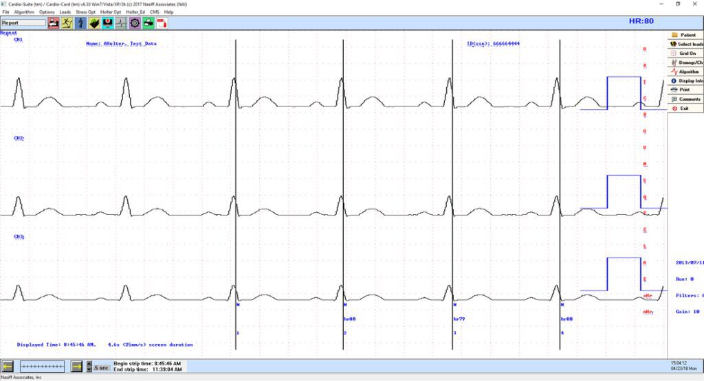 The Cardio Holter PC ECG - Nasiff Associates, Inc.