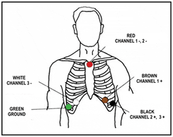 A diagram of a chest with red, green, and blue channels.